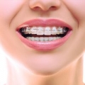 Greystone Orthodontics