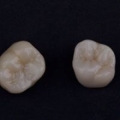 Alabama Ceramics Dental Lab