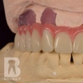 Becker Dental Labs