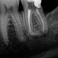 Liberty Endodontics