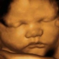 Tiny Toe S Prenatal Imaging